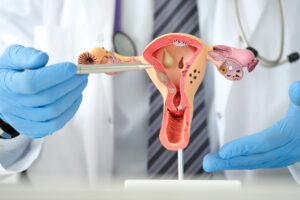 Puj Defination Pelvi-ureteric junction (PUJ) obstruction - MITR