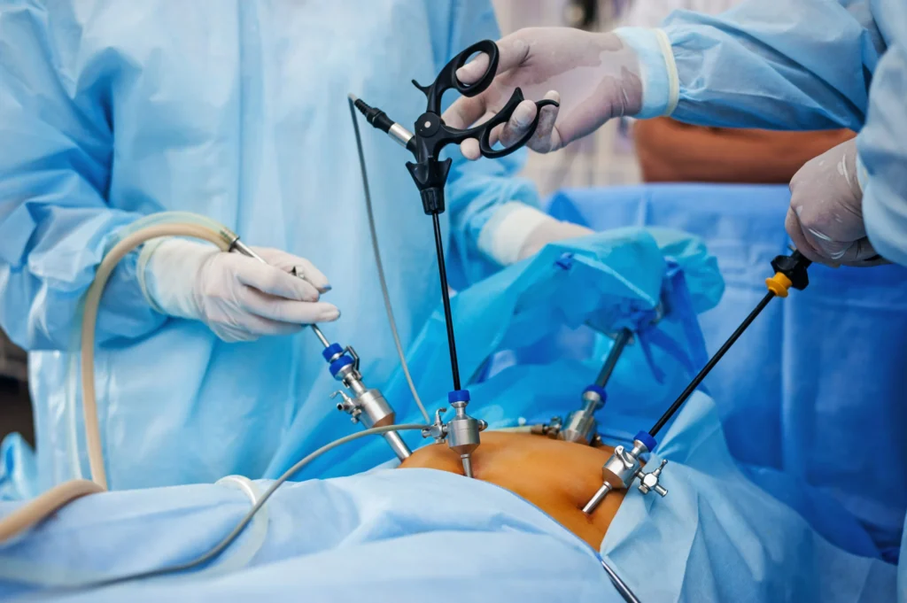 NAVIGATING FERTILITY CHALLENGES: UNDERSTANDING LAPAROSCOPIC OVARIAN CYSTECTOMY