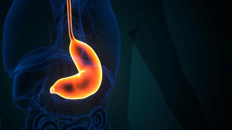 Peptic Ulcers in the Elderly: Understanding Unique Challenges and Solutions