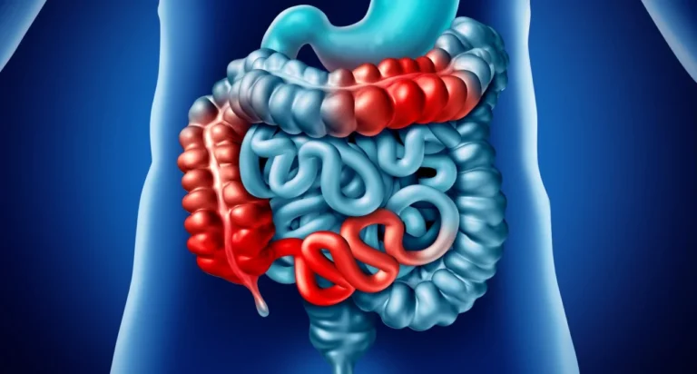 Navigating Nutrition for Crohn’s Disease: Best and Worst Foods