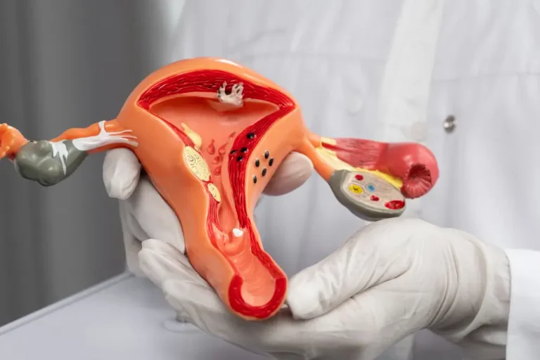 Hysterectomy Surgery in Navi Mumbai: What You Need to Know Before Choosingย MITRย Hospital