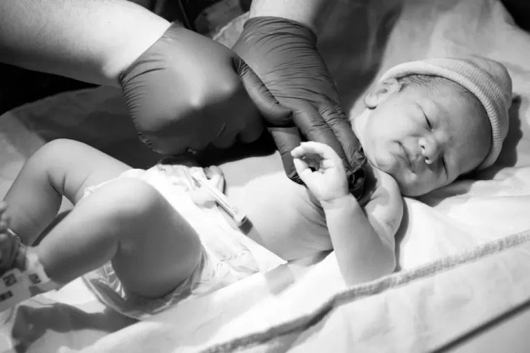 Penile Torsion in Newborns: What Parents Should Know