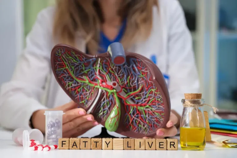 Understanding Metabolic Dysfunction-Associated Steatotic Liver Disease (MASLD): Causes, Diagnosis & Treatment