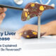Fatty Liver Disease