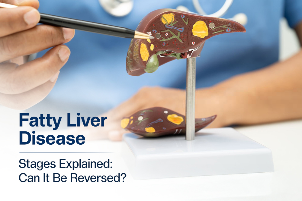 Fatty Liver Disease