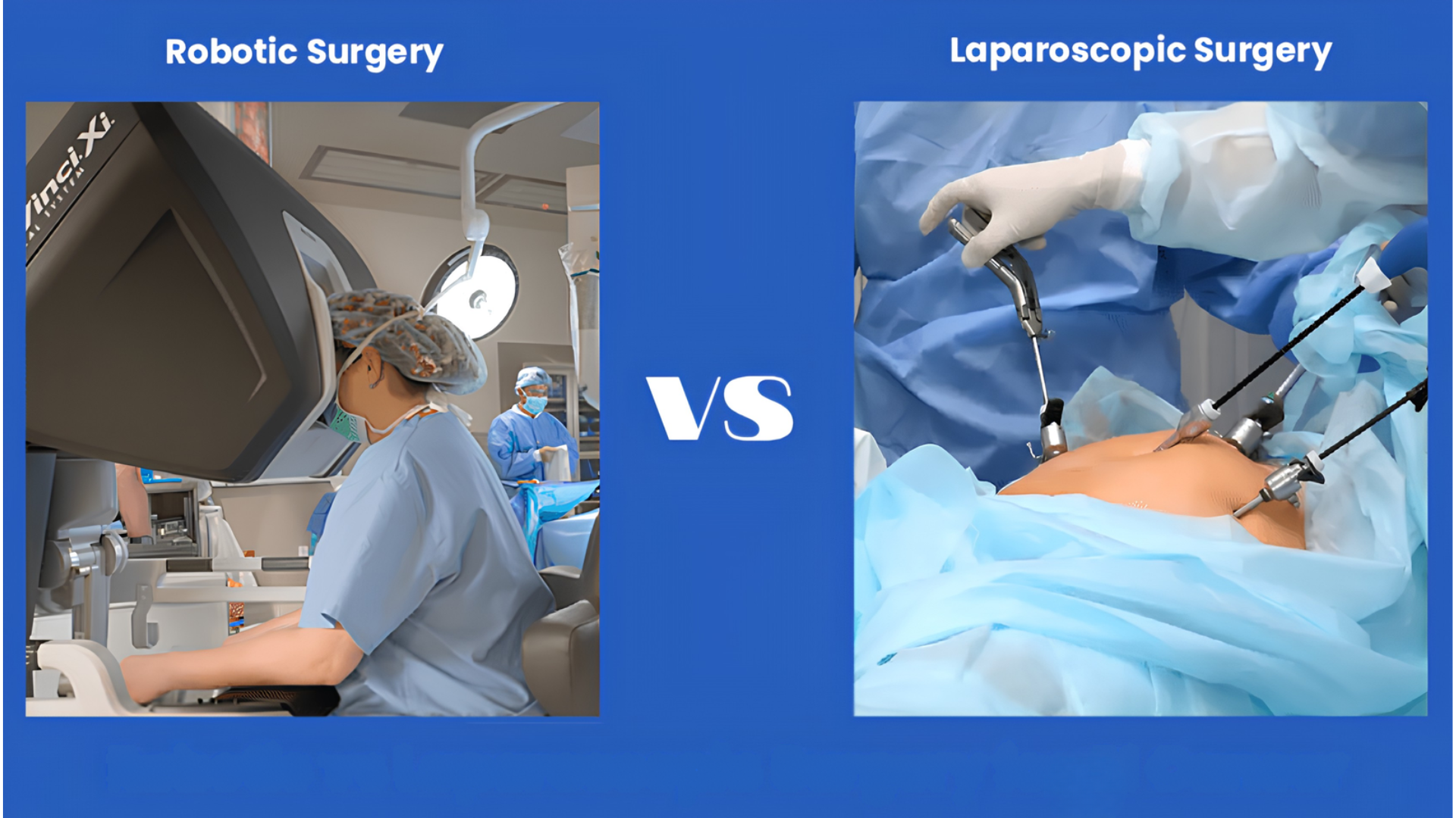 A comparison image showing a surgeon operating a robotic surgery system on the left and a laparoscopic surgery procedure on a patient's abdomen on the right, with VS in the centre.