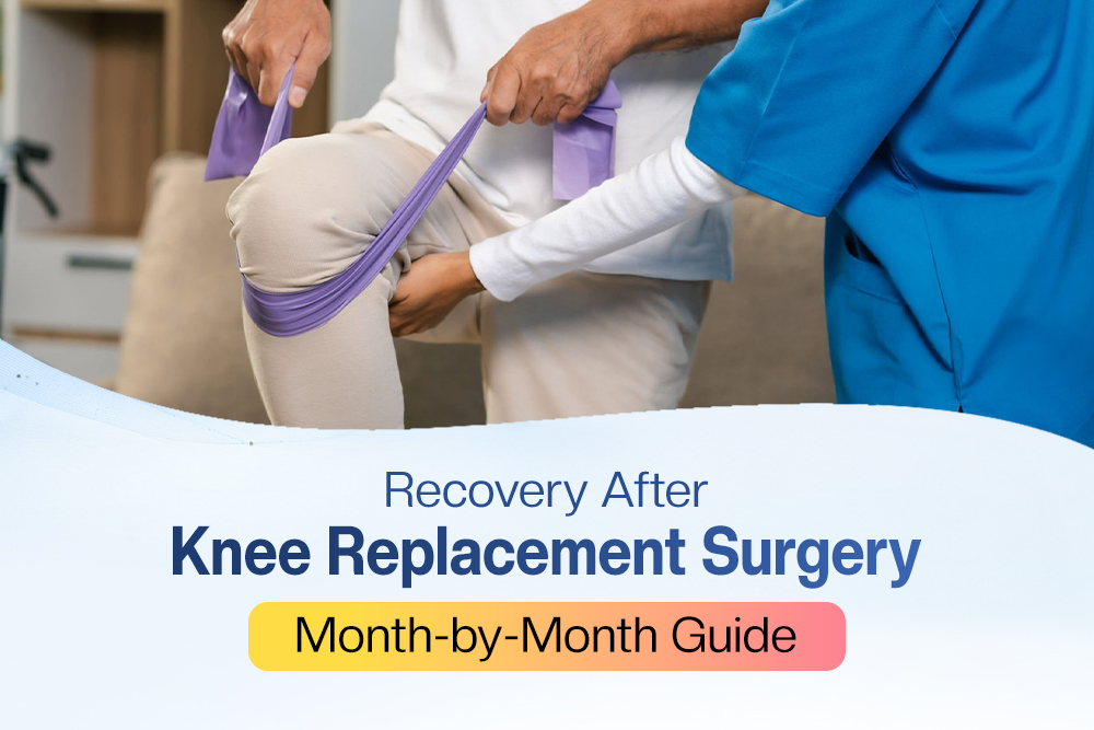 Recovery After Knee Replacement Surgery: Month-by-Month Guide knee replacement recovery​