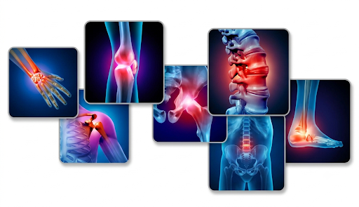 joint pains