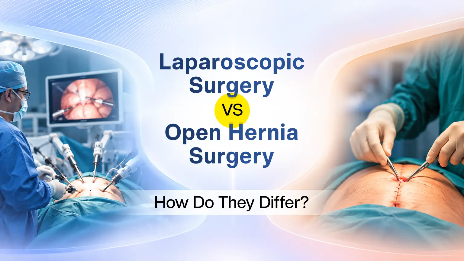 Graphic comparing laparoscopic and open hernia surgery, with a surgeon operating on each side