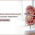 Painless Kidney Stone Removal? What “Minimally Invasive” Really Means in Kharghar