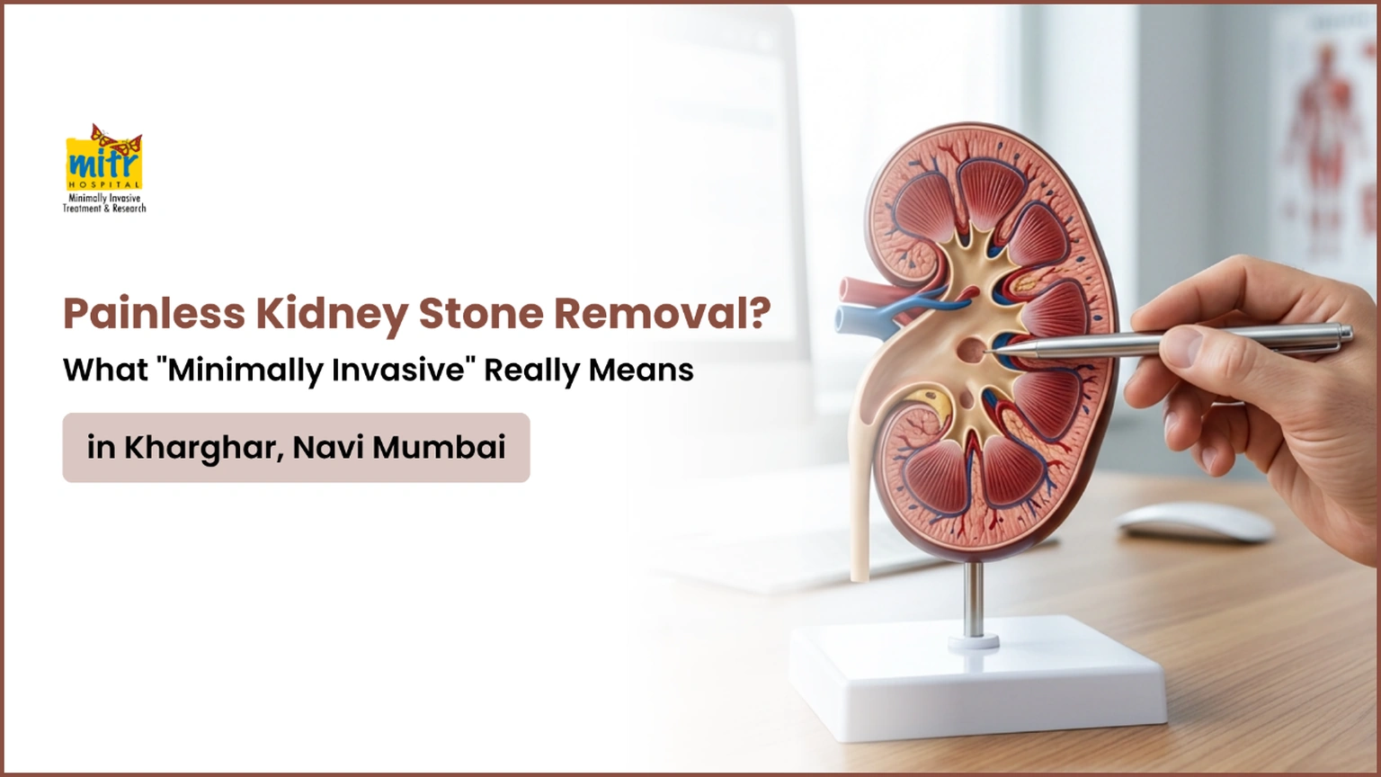 Painless Kidney Stone Removal