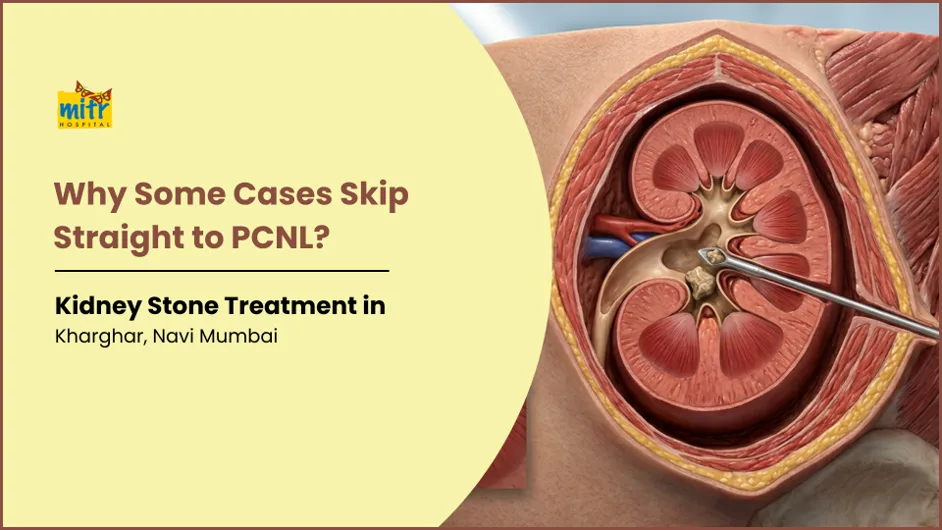 Why Do Some Kidney Stones Need PCNL Surgery Directly?