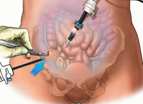 Department Of General, GI & Laparoscopic Surgery